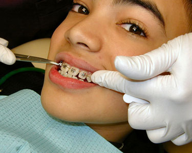 Kids St. Louis: Orthodontists - Fun 4 STL Kids